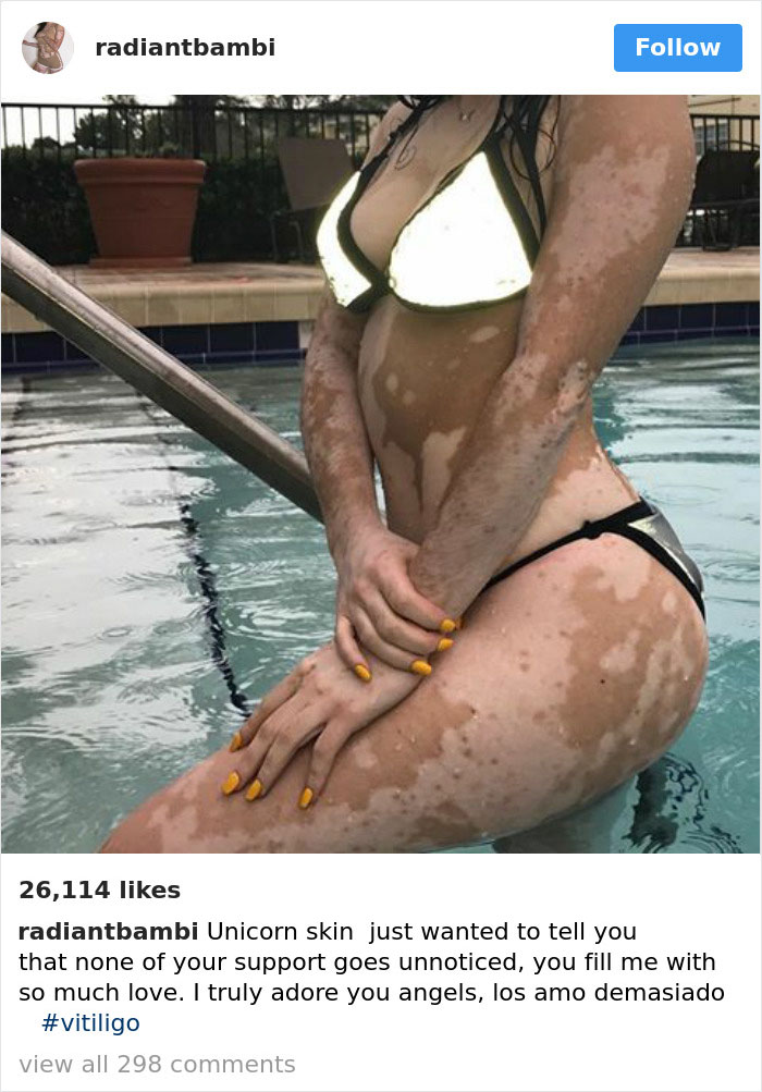 These 40 Women Ignored The Internet Shaming And Proved That Every Body Is Bikini Body 2