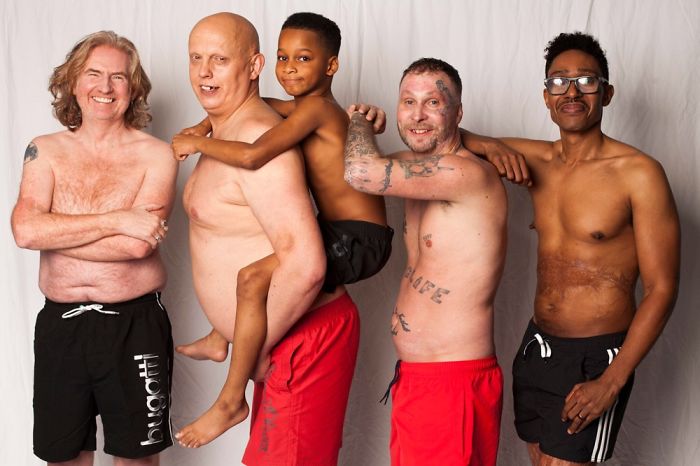 I Started This Campaign To Encourage People Love Themselves With All Their Differences 10