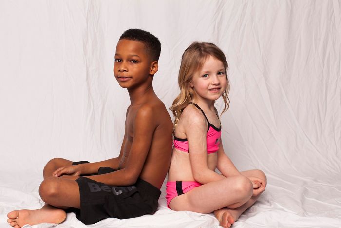 I Started This Campaign To Encourage People Love Themselves With All Their Differences 11