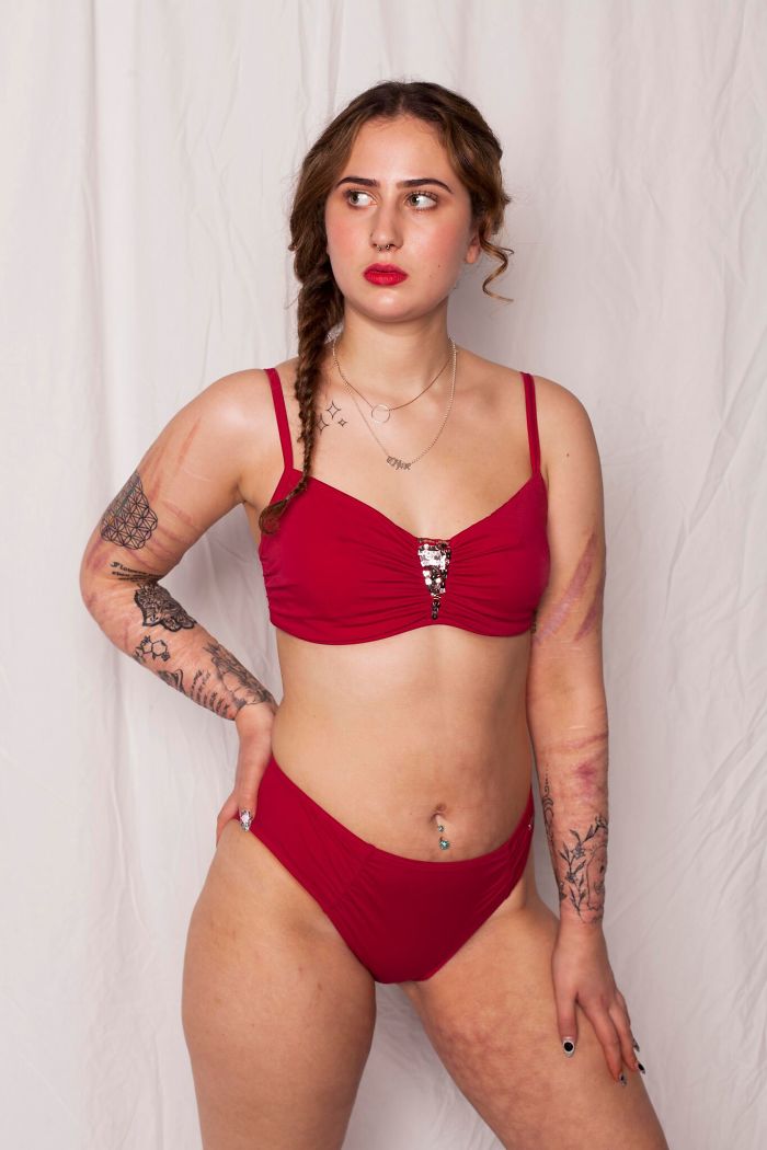 I Started This Campaign To Encourage People Love Themselves With All Their Differences 2