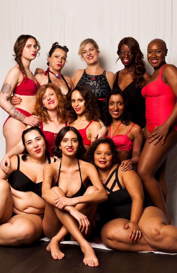 I Started This Campaign To Encourage People Love Themselves With All Their Differences 3