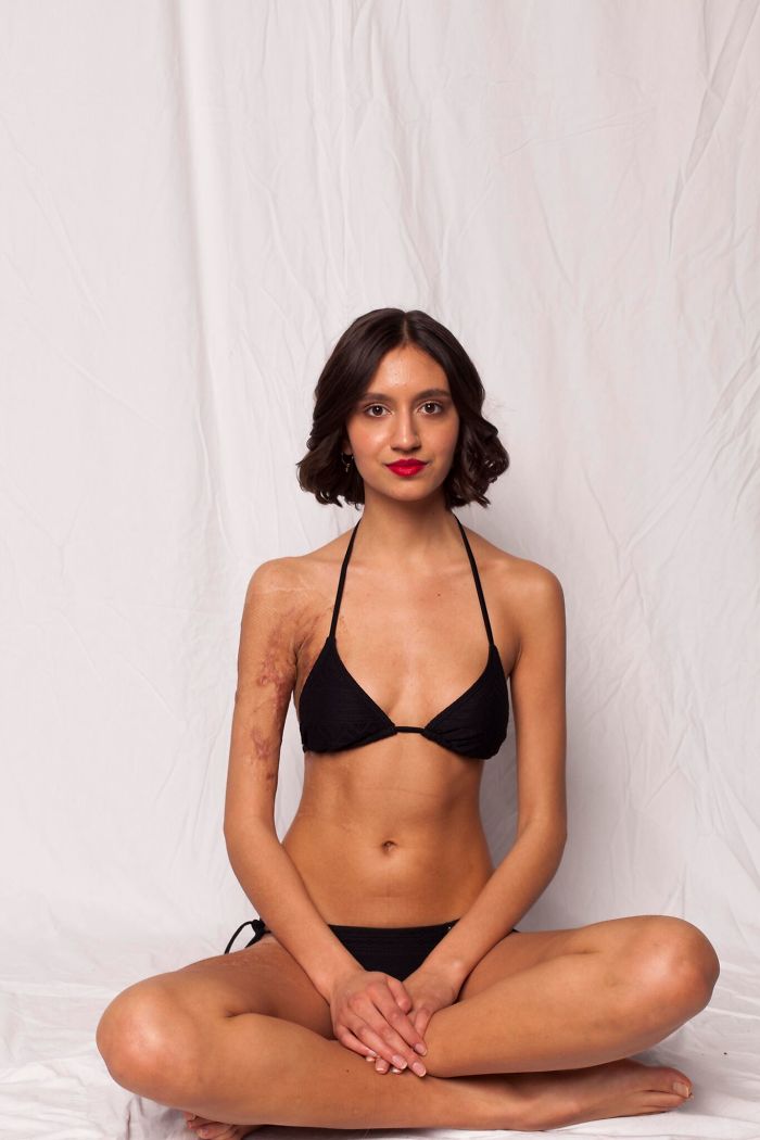 I Started This Campaign To Encourage People Love Themselves With All Their Differences 6