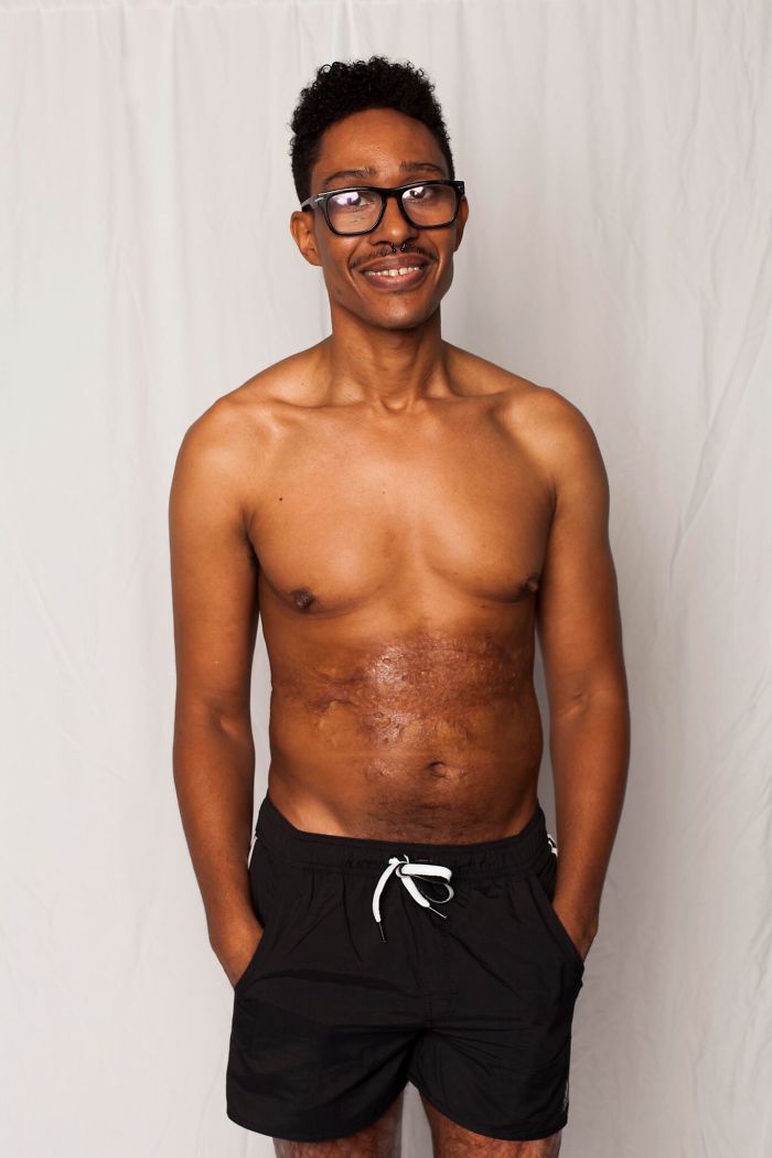 I Started This Campaign To Encourage People Love Themselves With All Their Differences 7