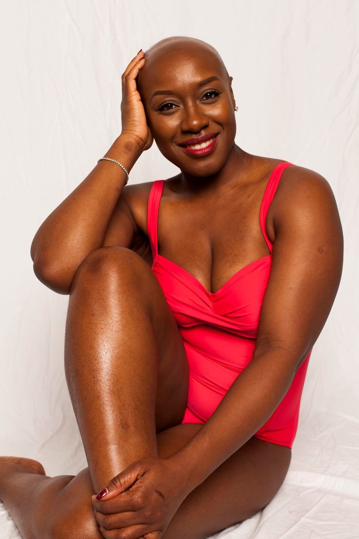 I Started This Campaign To Encourage People Love Themselves With All Their Differences 8
