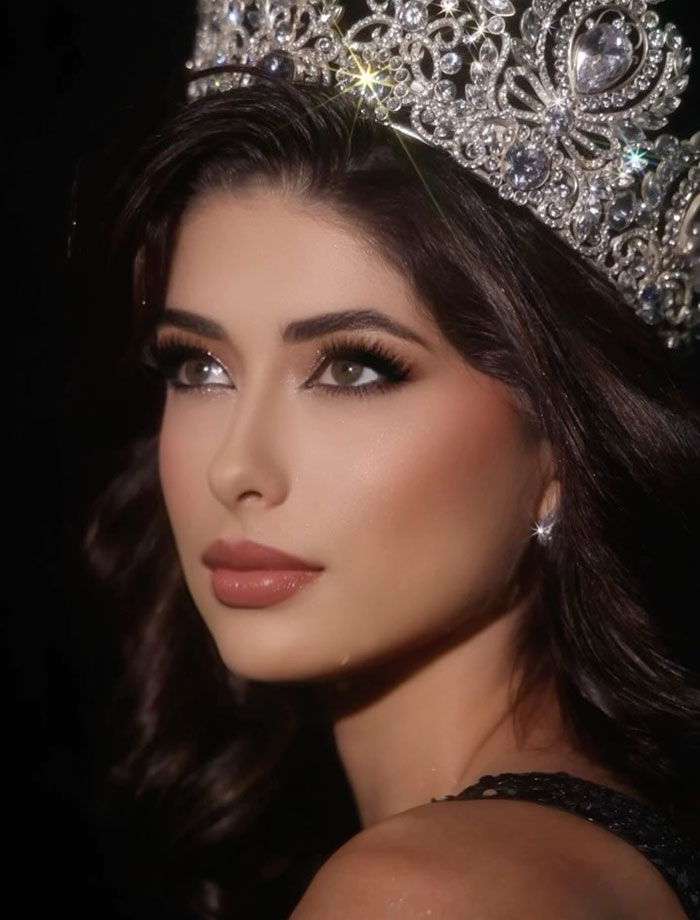 People Blast Miss Universe Contestant Who Got Axed Over Personal Scandal: “You Disappointed Us” 2