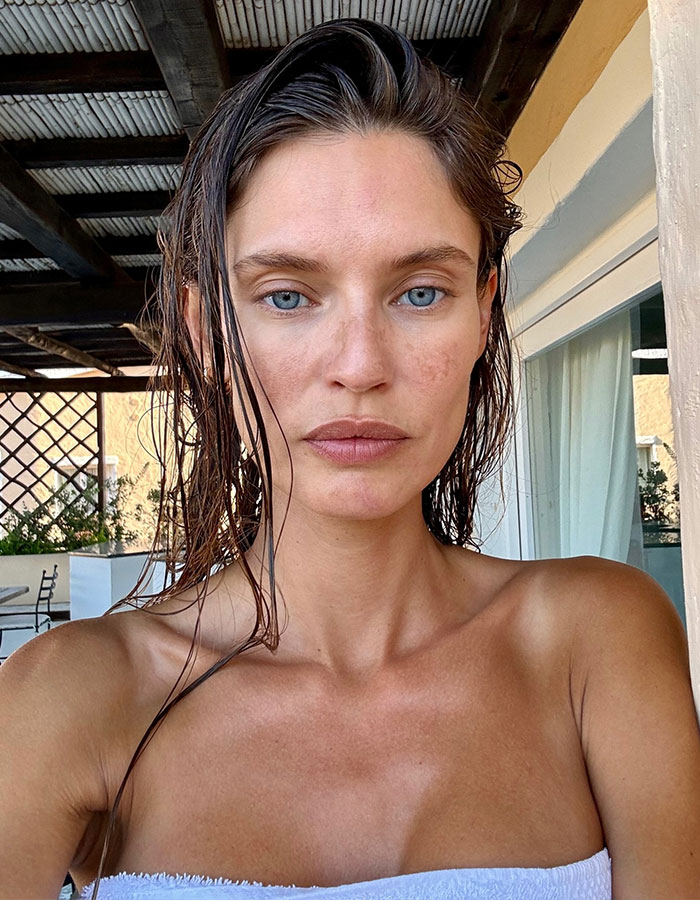 “Bad PR”: Ex–Victoria’s Secret Model Battling Cancer Reveals She Was Rejected From This Year’s Show 2