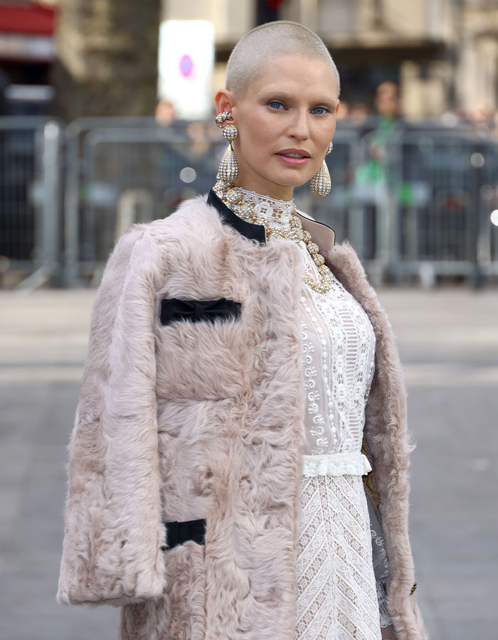 “Bad PR”: Ex–Victoria’s Secret Model Battling Cancer Reveals She Was Rejected From This Year’s Show 7