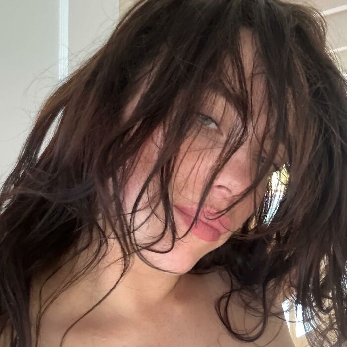 “I’m Drooling”: Billie Eilish Reveals Mystery Bite Marks Along With Rare Bikini Post 2