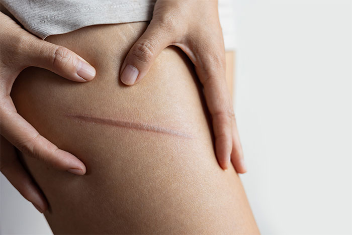 Woman Refuses To Cover Her Scar After It Triggers Her Friend At The Beach, Drama Ensues 8