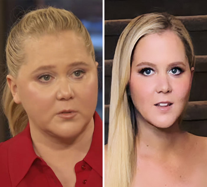 Amy Schumer’s Bikini Shots Stun After Major Weight Loss Transformation 10