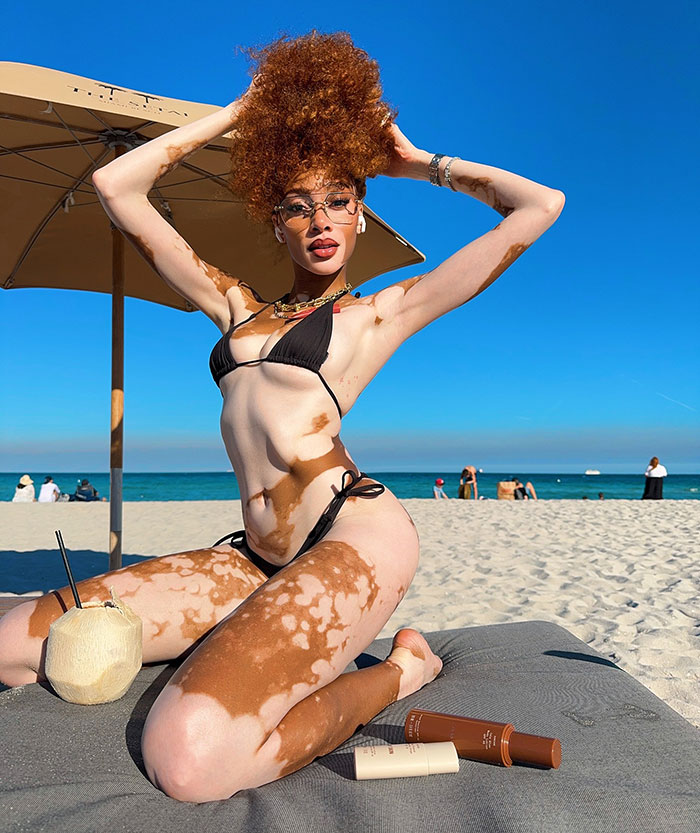 “Michael Jackson Probably Would’ve Been Fascinated By Her”: 31-Year-Old Winnie Harlow Goes Viral 2