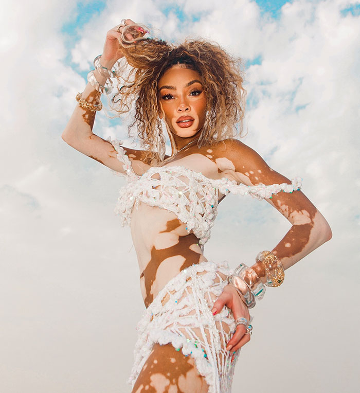 “Michael Jackson Probably Would’ve Been Fascinated By Her”: 31-Year-Old Winnie Harlow Goes Viral 12