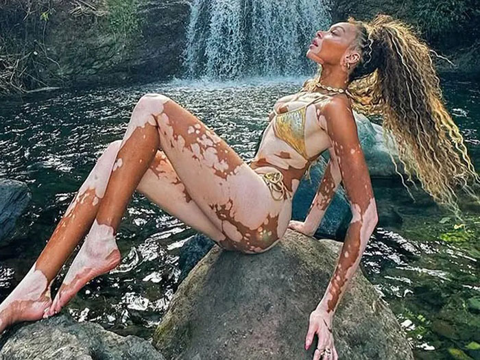 “Michael Jackson Probably Would’ve Been Fascinated By Her”: 31-Year-Old Winnie Harlow Goes Viral 3