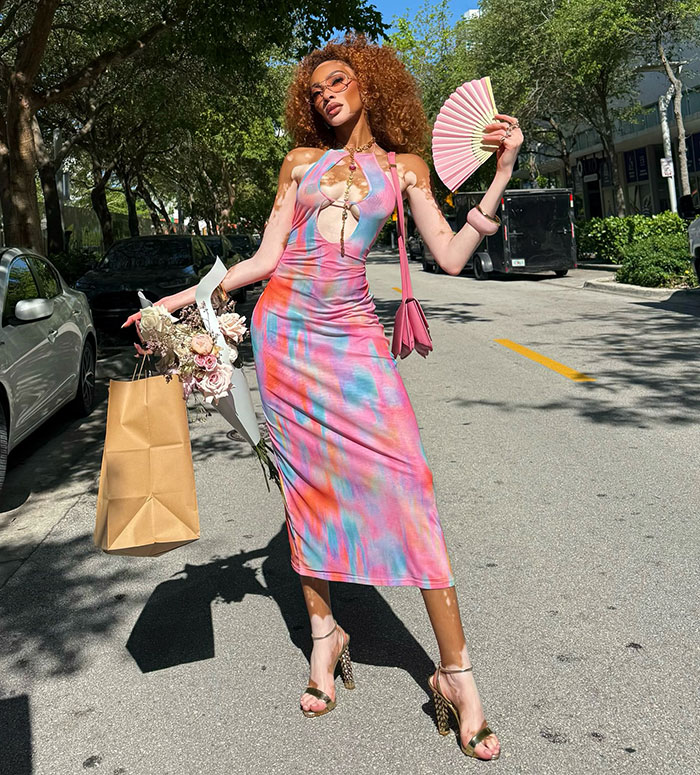“Michael Jackson Probably Would’ve Been Fascinated By Her”: 31-Year-Old Winnie Harlow Goes Viral 5