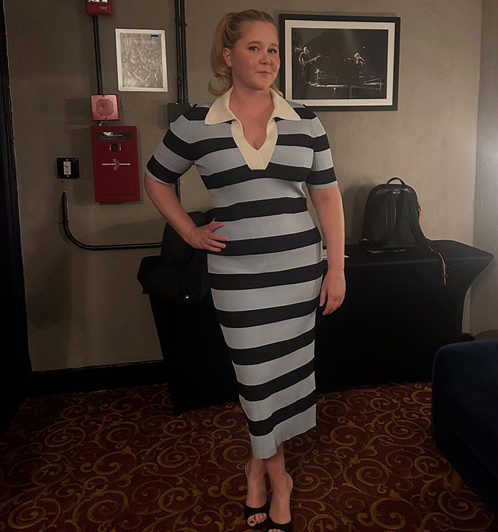 “The Swimsuit Picture Is Obviously Altered”: Fans Notice The Mounjaro Effect In Amy Schumer’s Latest IG Post 7