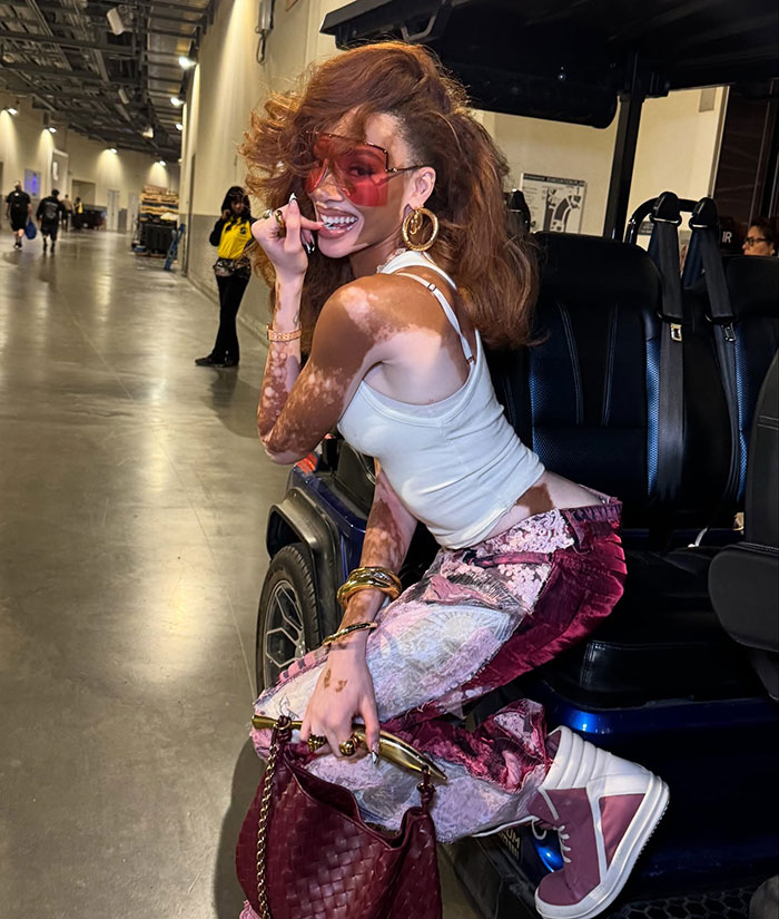 “Michael Jackson Probably Would’ve Been Fascinated By Her”: 31-Year-Old Winnie Harlow Goes Viral 10