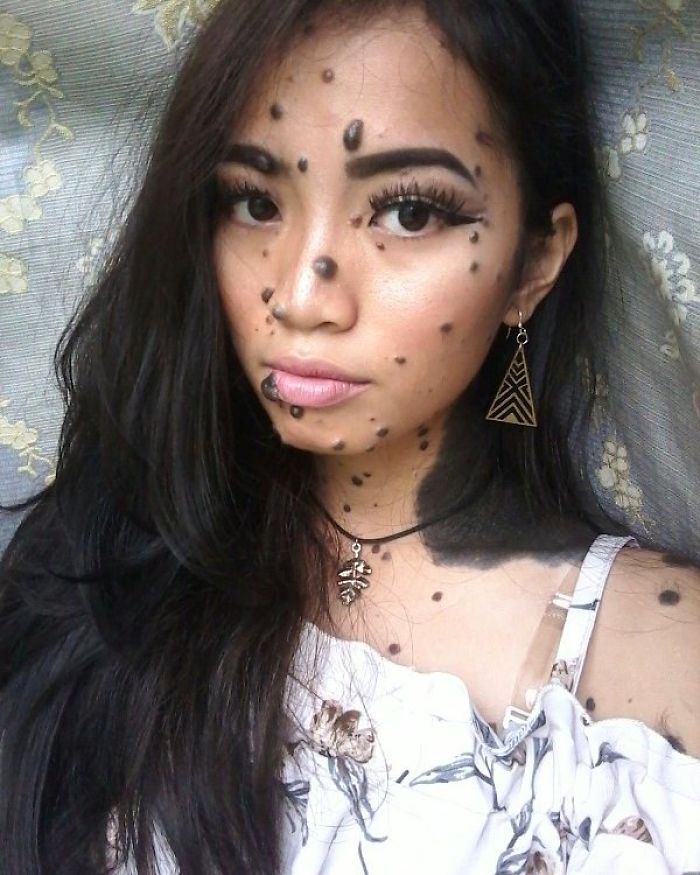 Woman Who Was Called A Monster For Her Head-To-Toe Hairy Moles Might Be The Next Miss Universe 1