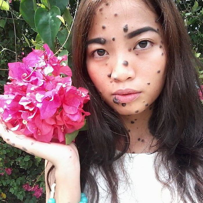 Woman Who Was Called A Monster For Her Head-To-Toe Hairy Moles Might Be The Next Miss Universe 3