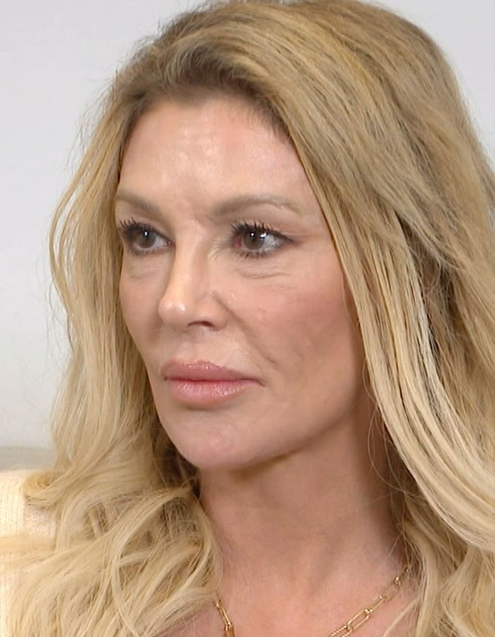 “Psychosis On Display”: Brandi Glanville Goes Bold In Red Bikini After Face Disfigurement Diagnosis 3