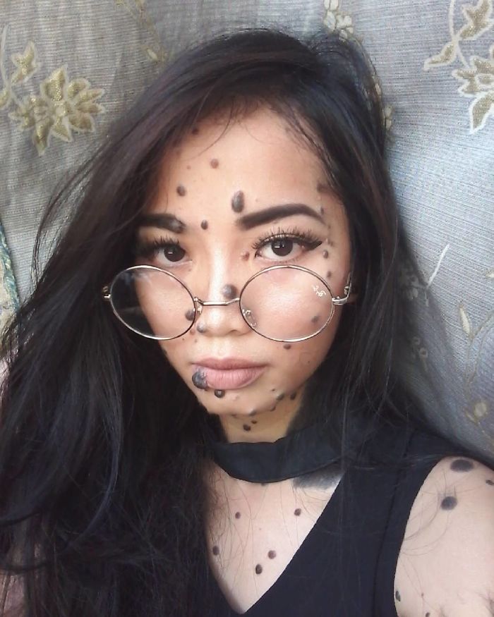 Woman Who Was Called A Monster For Her Head-To-Toe Hairy Moles Might Be The Next Miss Universe 5