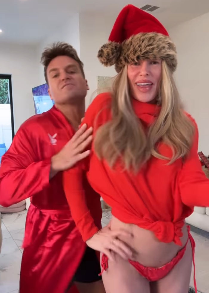 “Psychosis On Display”: Brandi Glanville Goes Bold In Red Bikini After Face Disfigurement Diagnosis 5