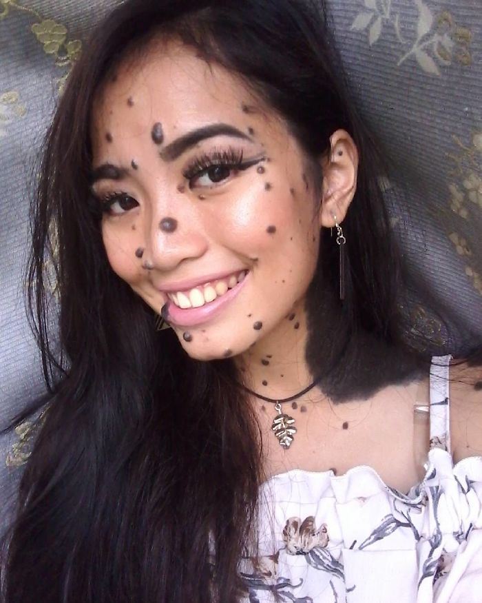 Woman Who Was Called A Monster For Her Head-To-Toe Hairy Moles Might Be The Next Miss Universe 7