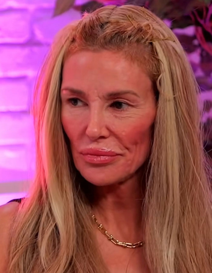“Psychosis On Display”: Brandi Glanville Goes Bold In Red Bikini After Face Disfigurement Diagnosis 8
