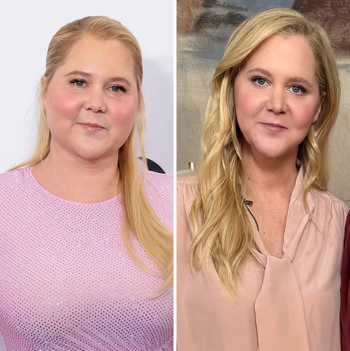 “He Is Better Off”: Amy Schumer Fires Back As Fans Slammed Her Bikini Pics After Divorce Filing 9