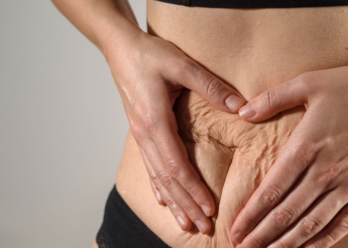 Woman Demands Sister Cover Up Her Bikini, Throws A Fit When She Refuses 5